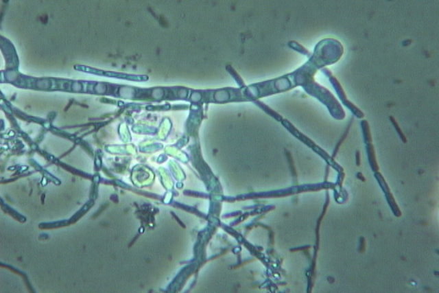 Fungal%20Hyphae%20barn%20compost%20w%20mol.JPG