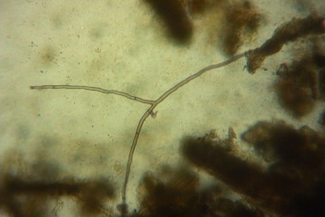 Pretty%20fungal%20hyphae%20barn%20vc%20250Xbf.JPG